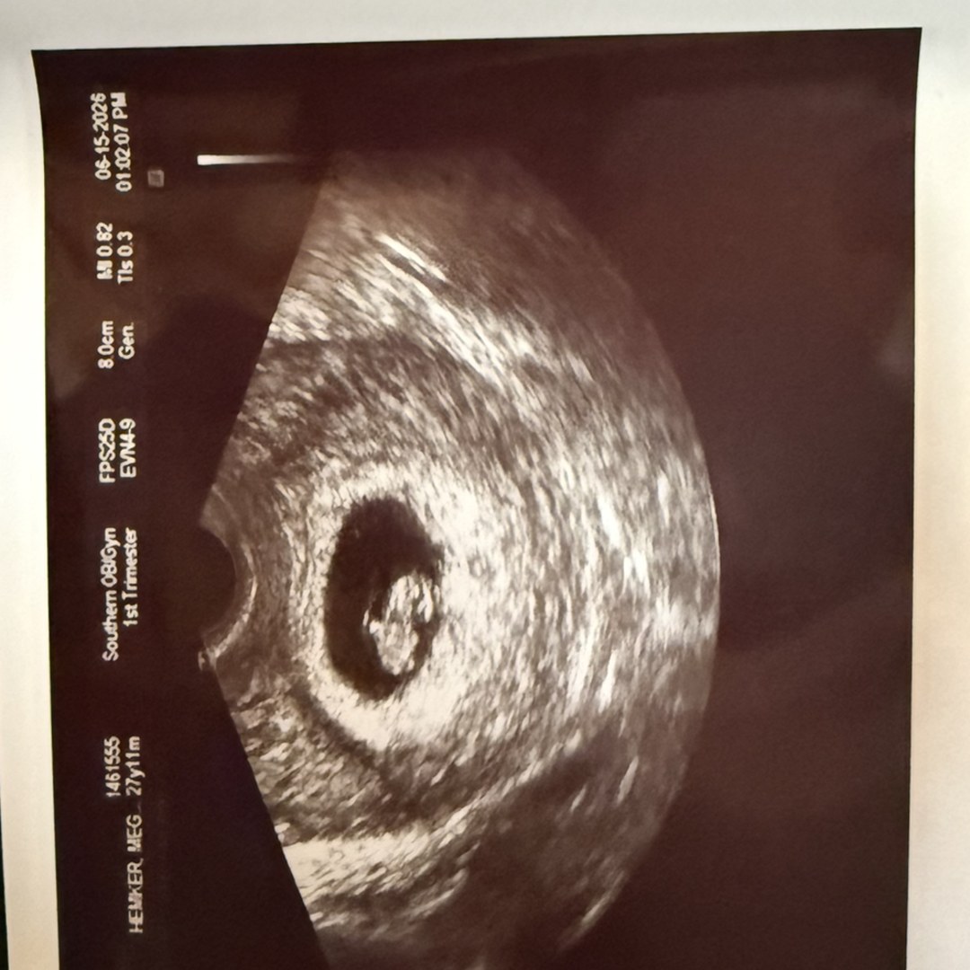 Photo shared by Meghan for their Babylist baby registry.