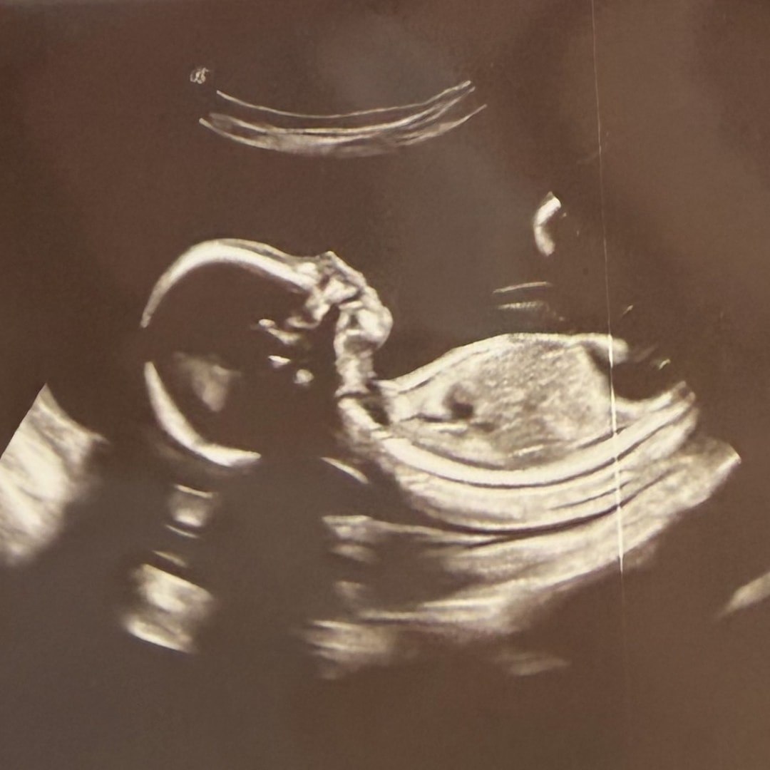Photo shared by Caroline for their Babylist baby registry.