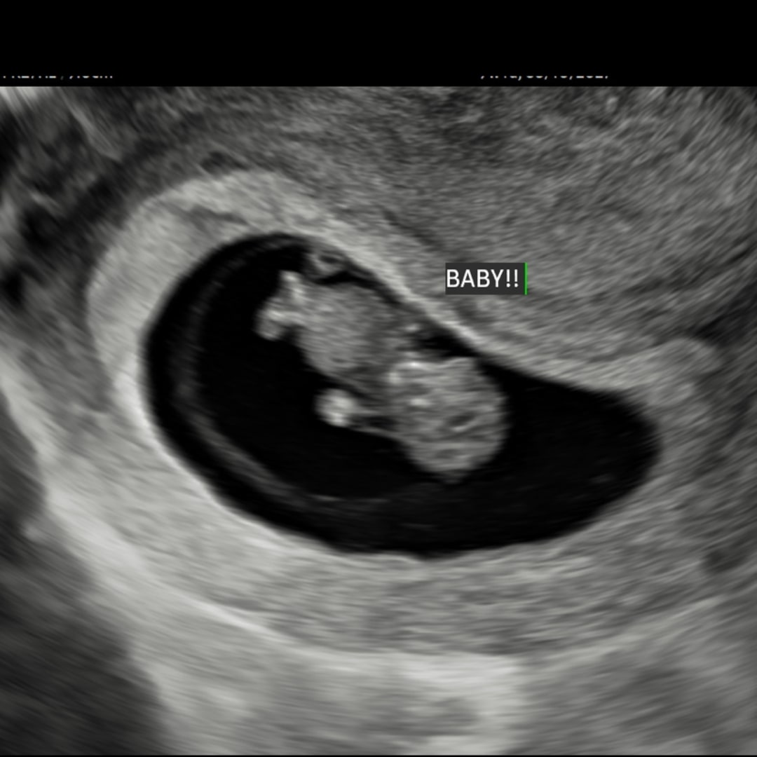 Photo shared by Amirah for their Babylist baby registry.