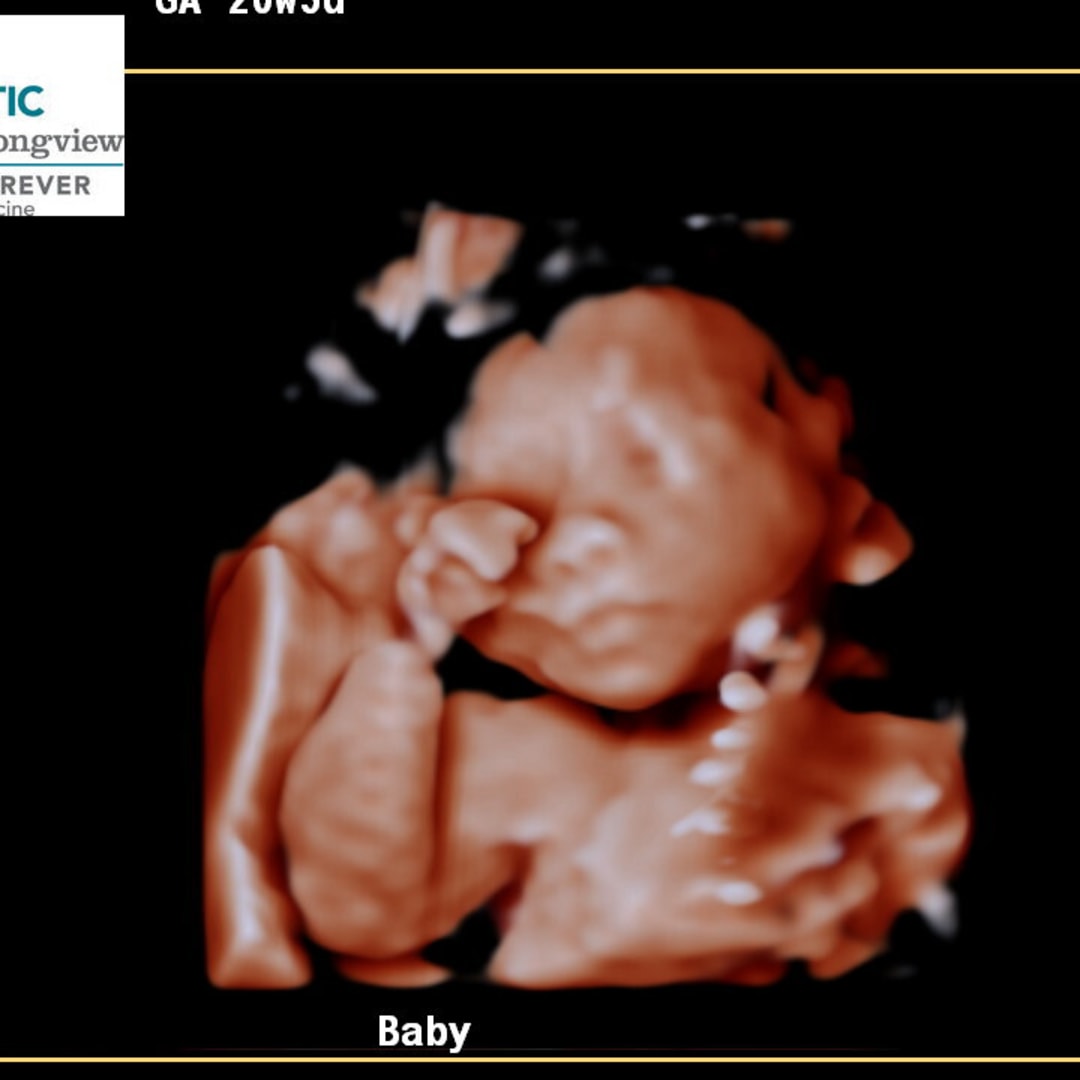 Photo shared by Alejandra for their Babylist baby registry.