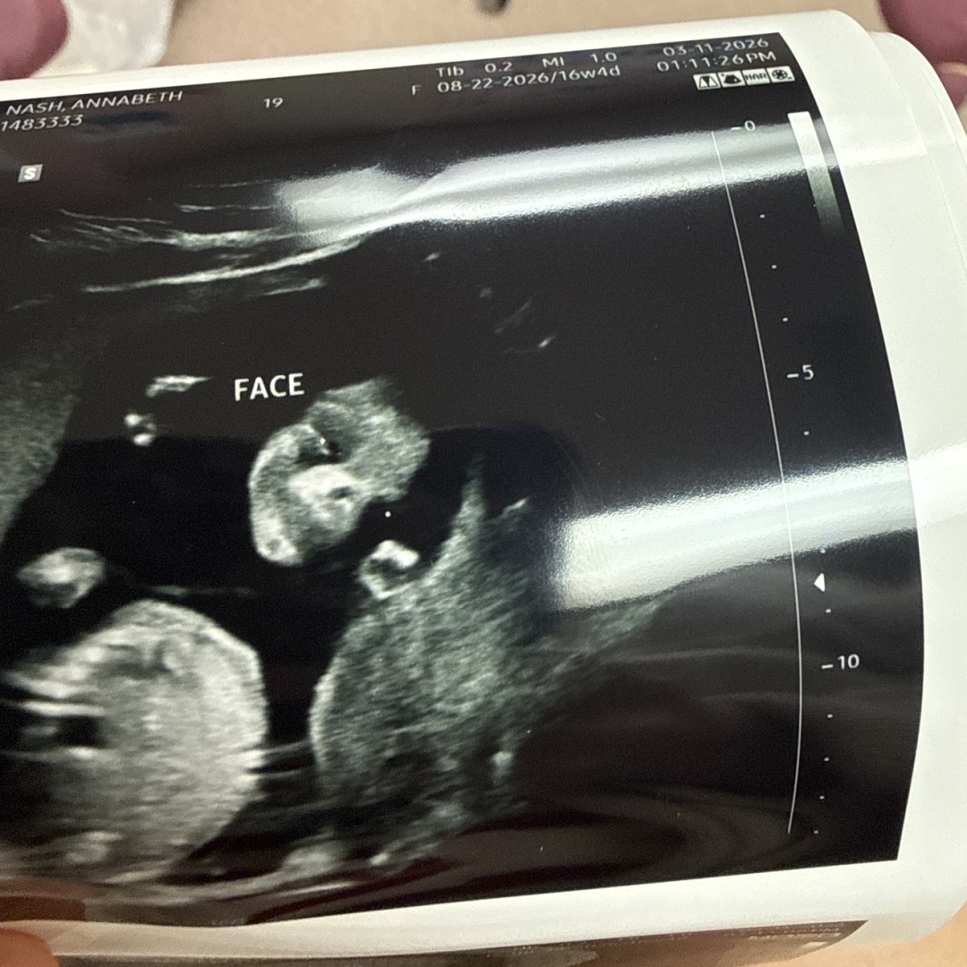 Photo shared by Annabeth for their Babylist baby registry.