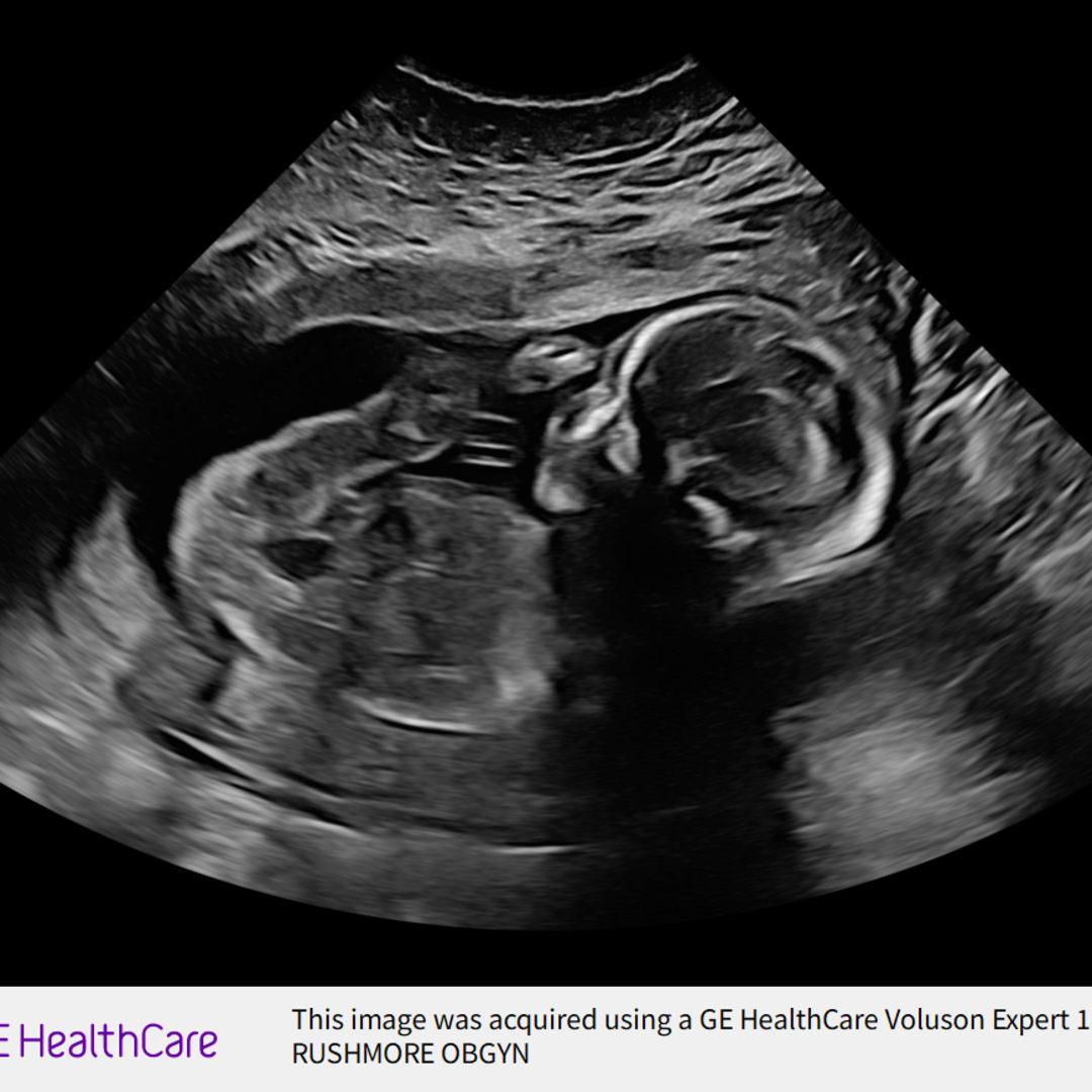 Photo shared by Ayra Denise for their Babylist baby registry.