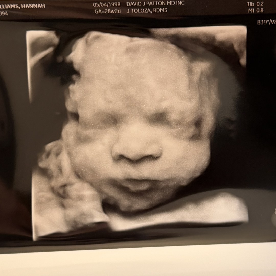 Photo shared by Hannah for their Babylist baby registry.
