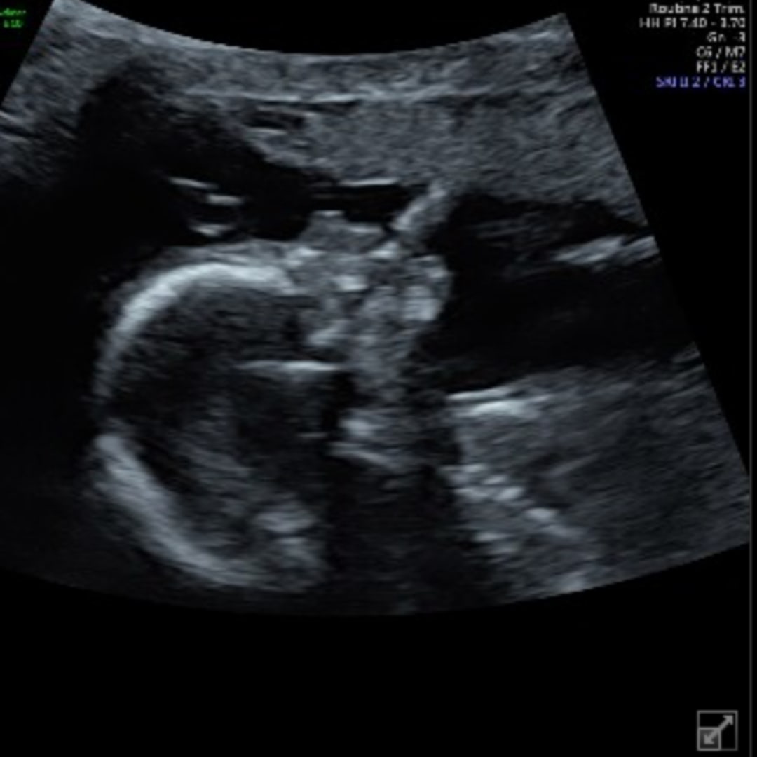 Photo shared by Emily for their Babylist baby registry.