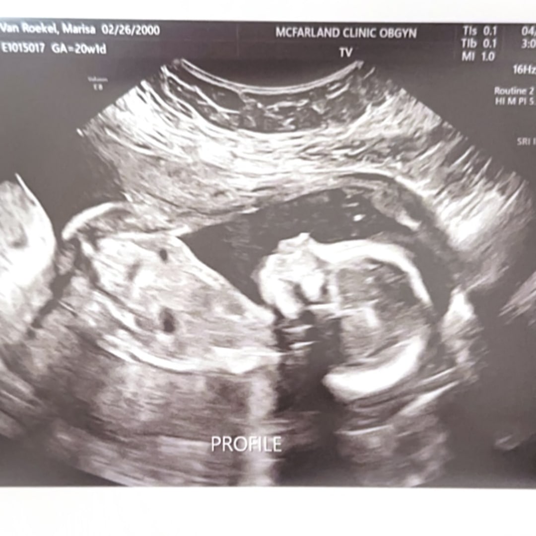 Photo shared by Marisa for their Babylist baby registry.