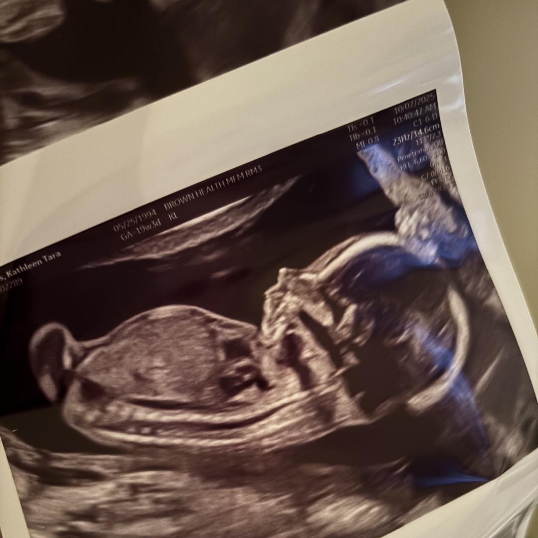 Photo shared by Katie for their Babylist baby registry.