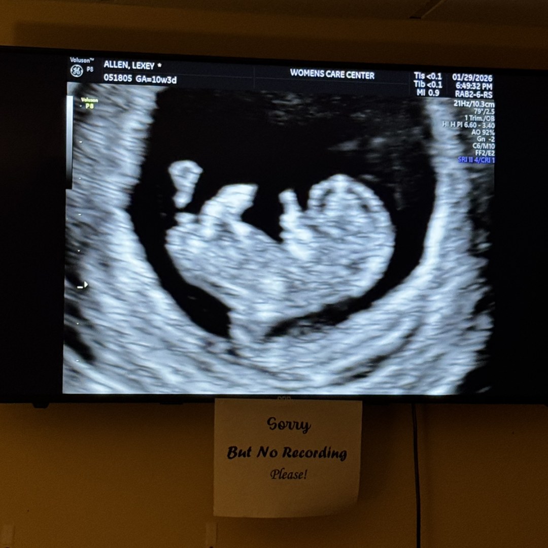 Photo shared by Lexey for their Babylist baby registry.
