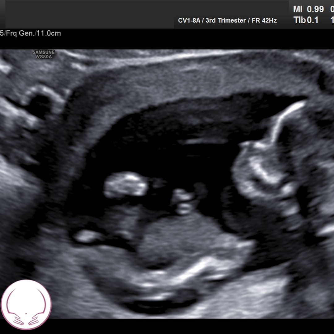 Photo shared by Ellie for their Babylist baby registry.