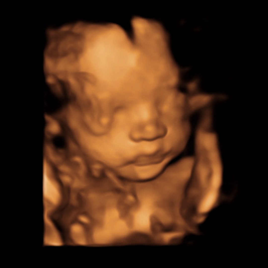 Photo shared by Shea for their Babylist baby registry.