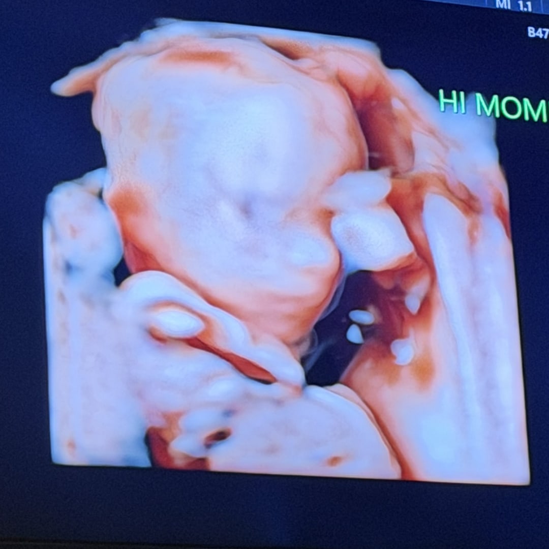 Photo shared by Gabrielle for their Babylist baby registry.