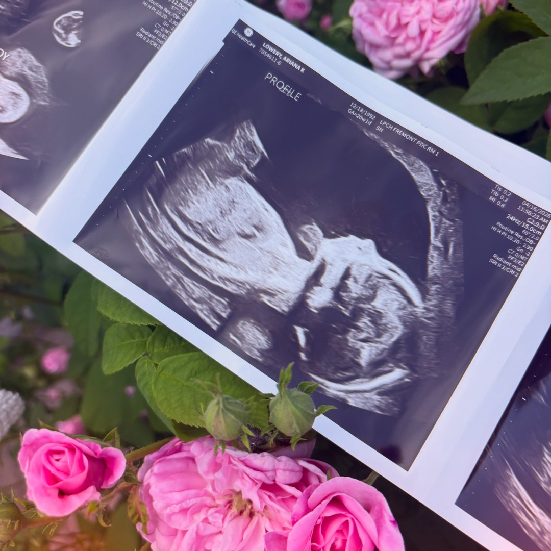 Photo shared by Ariana for their Babylist baby registry.