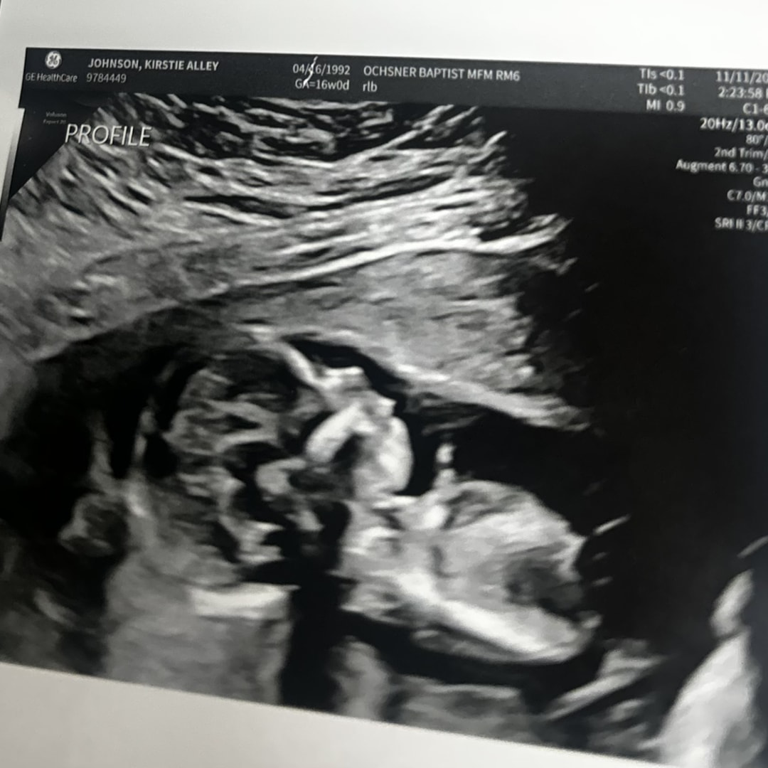 Photo shared by Kirstie for their Babylist baby registry.