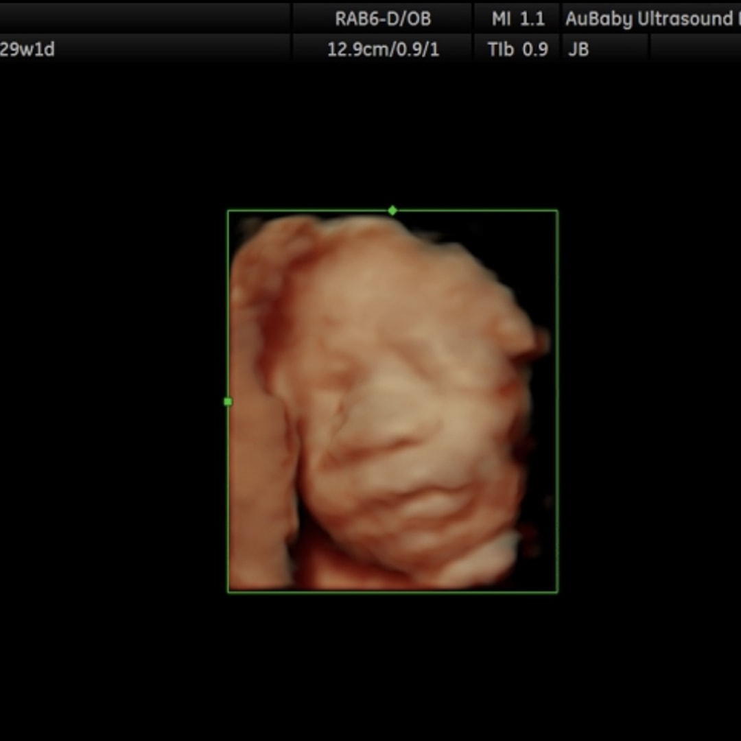 Photo shared by Ragan for their Babylist baby registry.