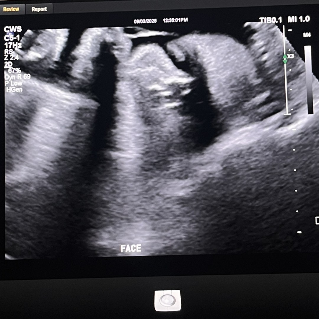Photo shared by Fay for their Babylist baby registry.