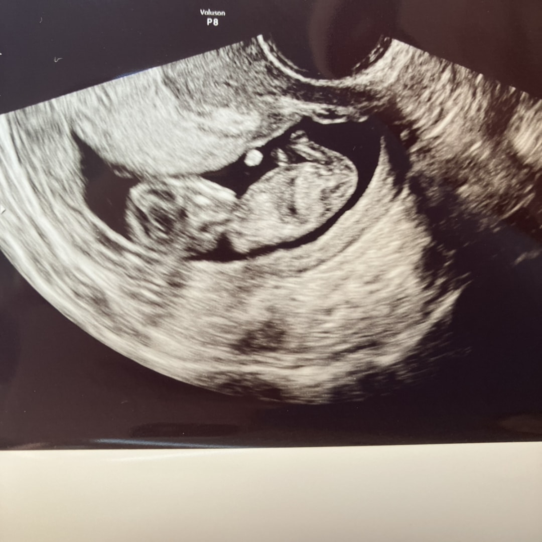 Photo shared by Audrey for their Babylist baby registry.