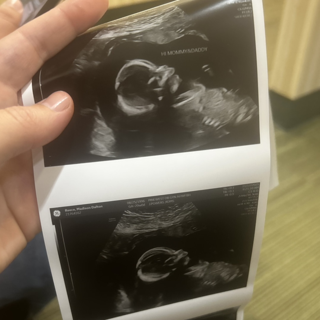 Photo shared by Madison for their Babylist baby registry.