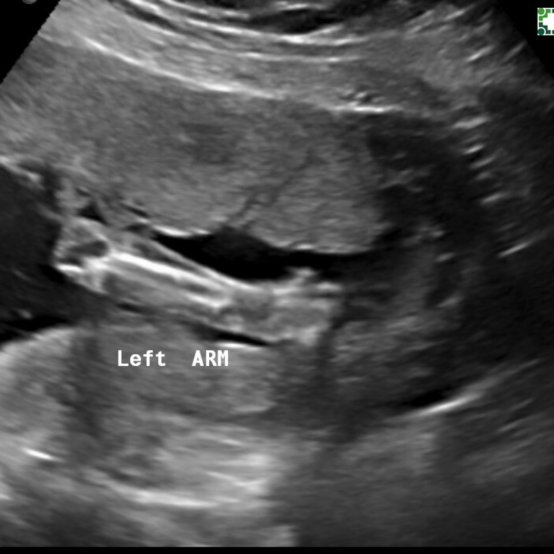 Photo shared by Maria for their Babylist baby registry.