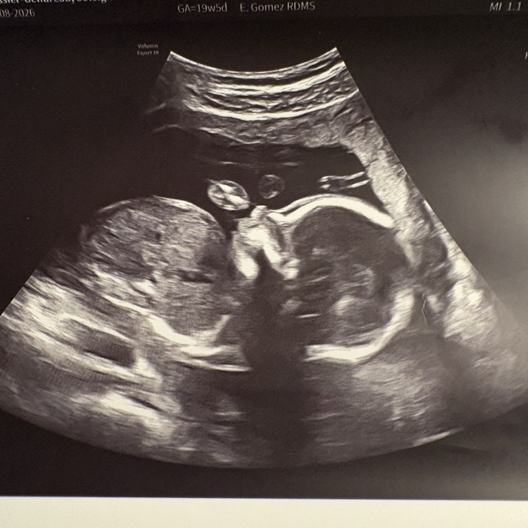 Photo shared by Joleigh for their Babylist baby registry.