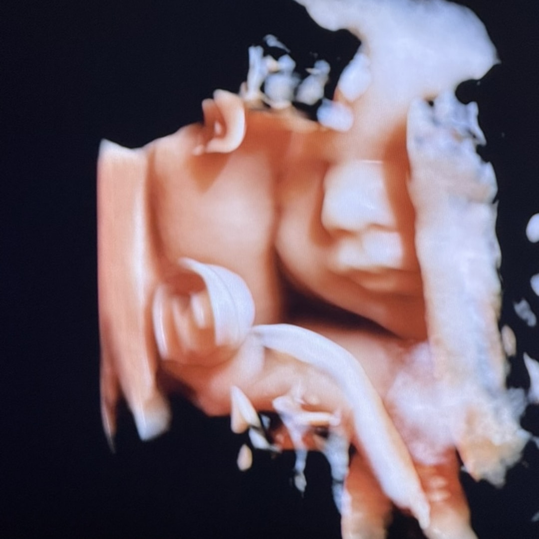 Photo shared by Rayna for their Babylist baby registry.