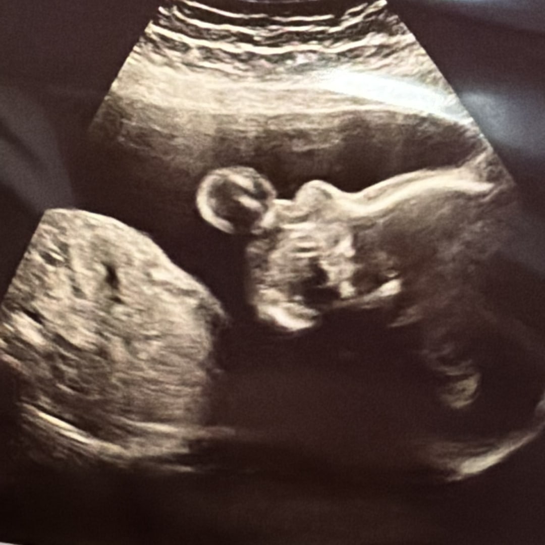 Photo shared by Elizabeth for their Babylist baby registry.