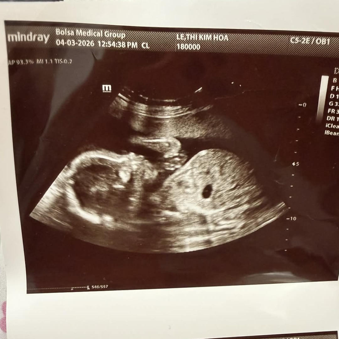 Photo shared by Thi for their Babylist baby registry.