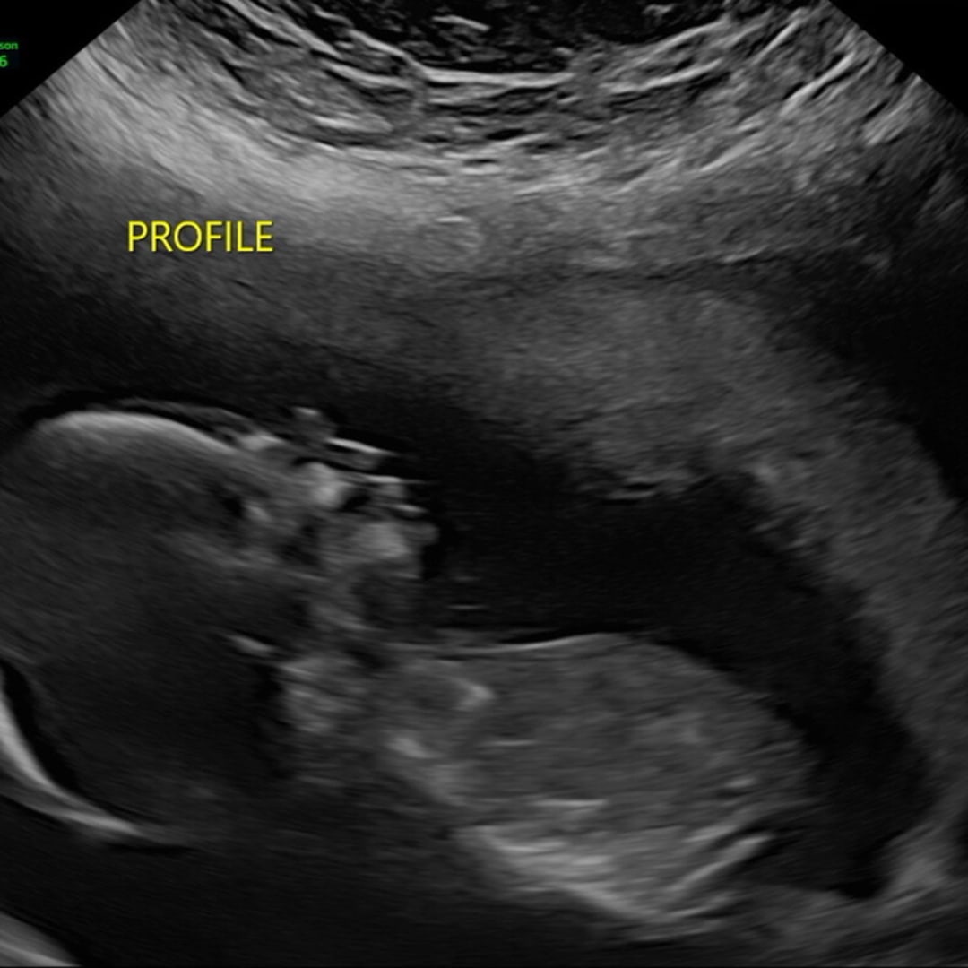 Photo shared by Hanna for their Babylist baby registry.
