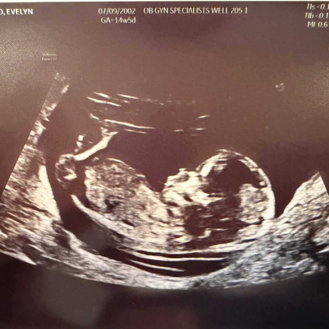Photo shared by Evelyn for their Babylist baby registry.