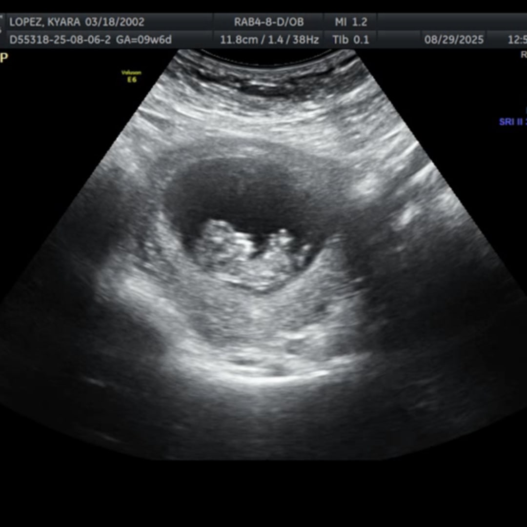 Photo shared by Kyara for their Babylist baby registry.