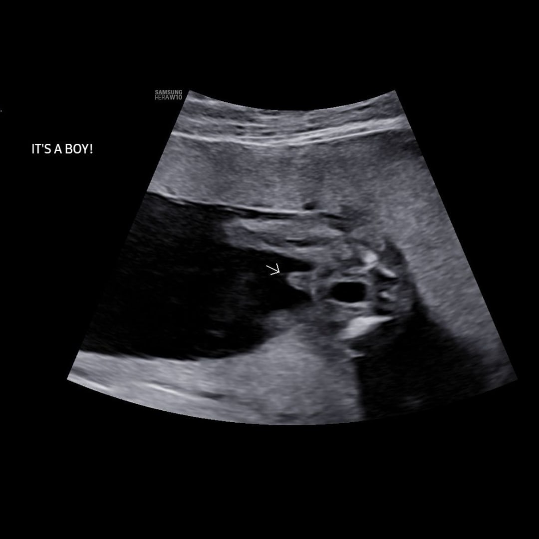 Photo shared by Taylor for their Babylist baby registry.