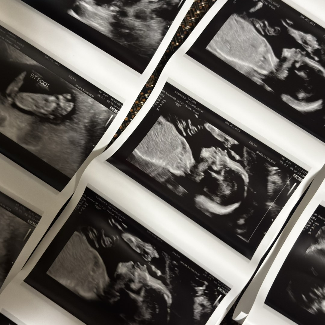 Photo shared by Kiiana for their Babylist baby registry.