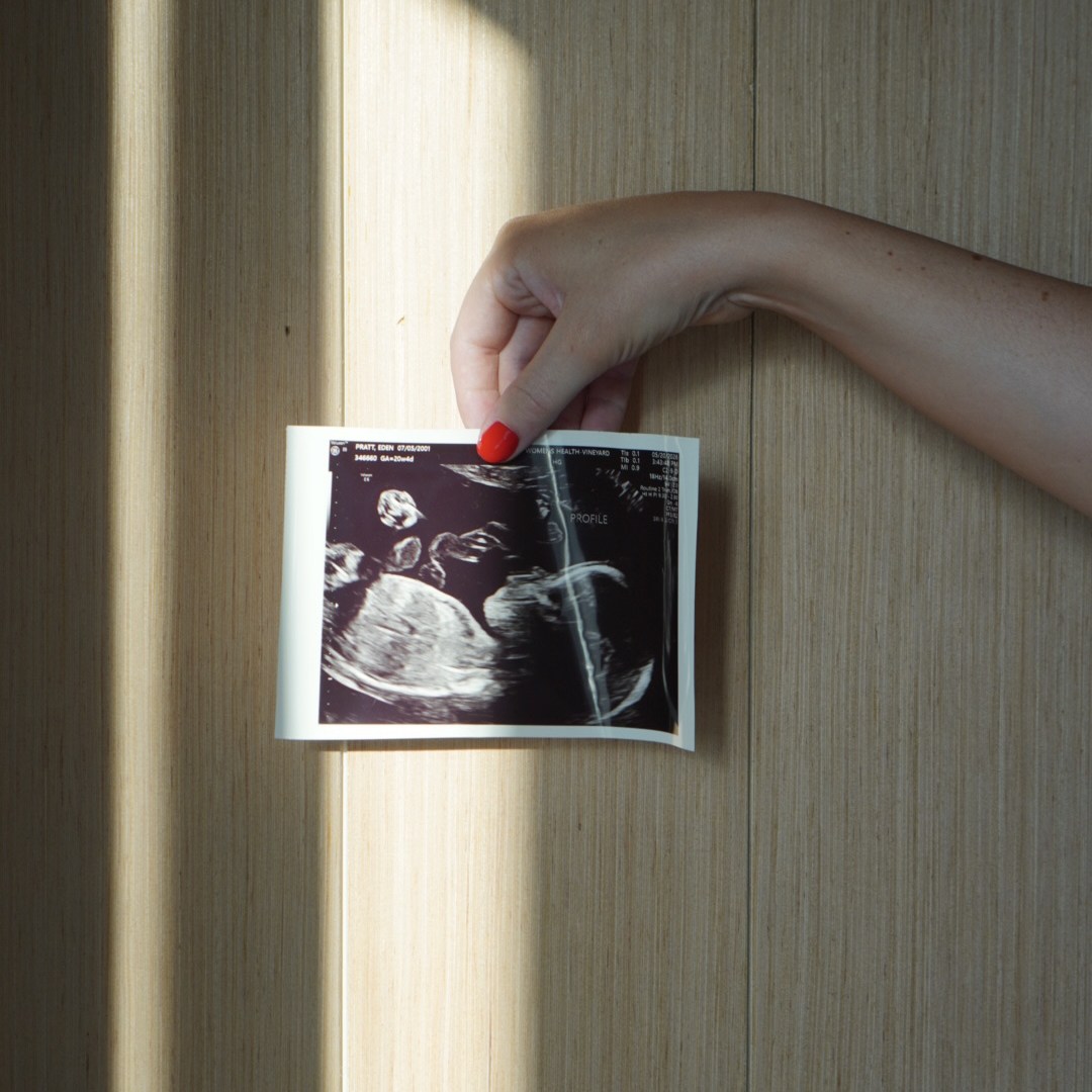Photo shared by Eden for their Babylist baby registry.