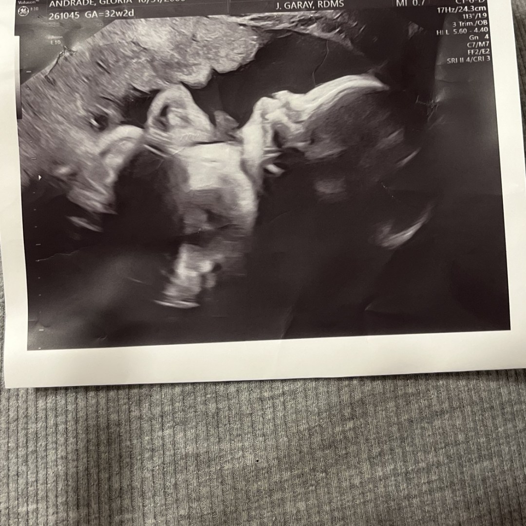 Photo shared by Gloria for their Babylist baby registry.