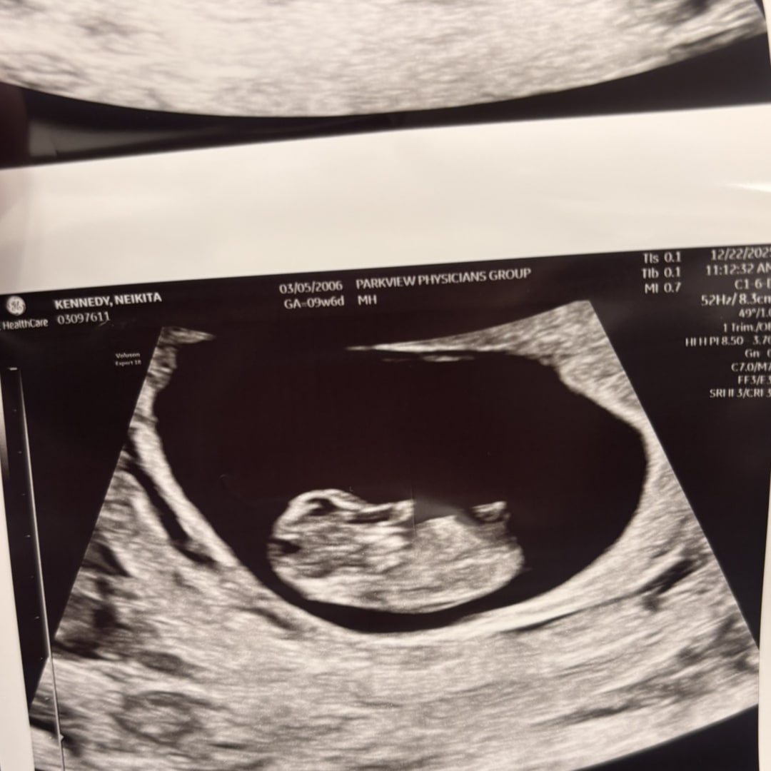 Photo shared by Neikita for their Babylist baby registry.