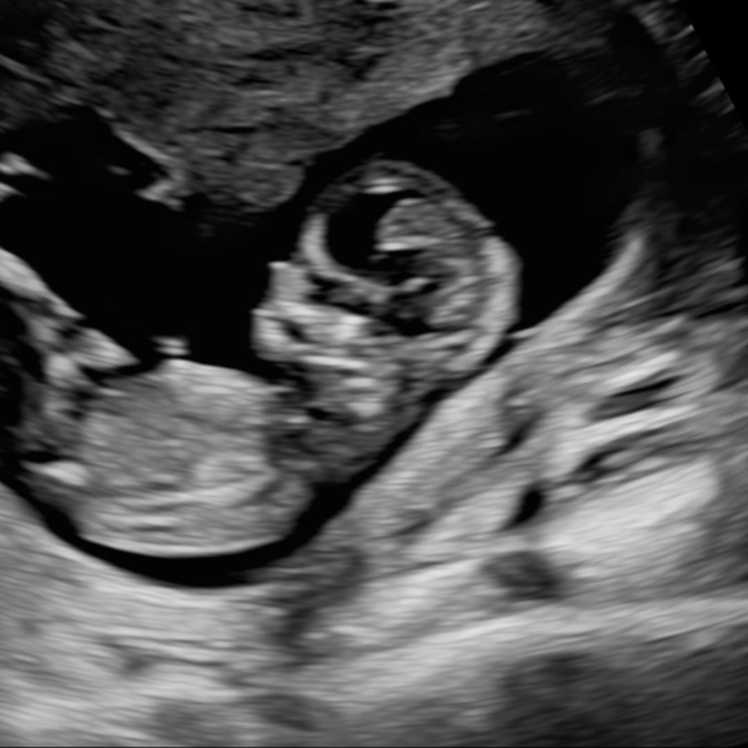 Photo shared by Brooke for their Babylist baby registry.
