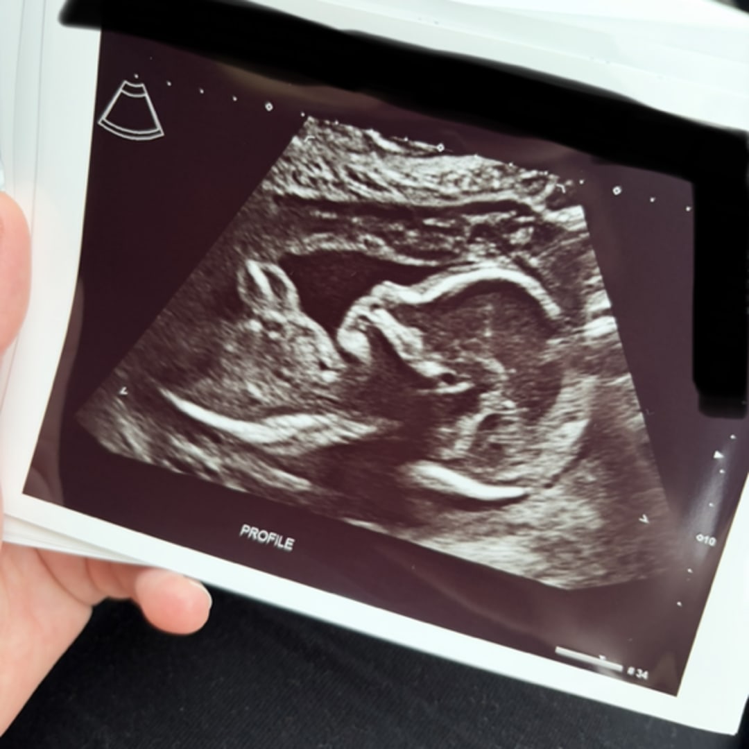 Photo shared by Paige for their Babylist baby registry.