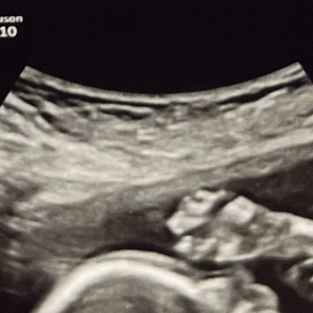 Photo shared by Kaitlyn for their Babylist baby registry.