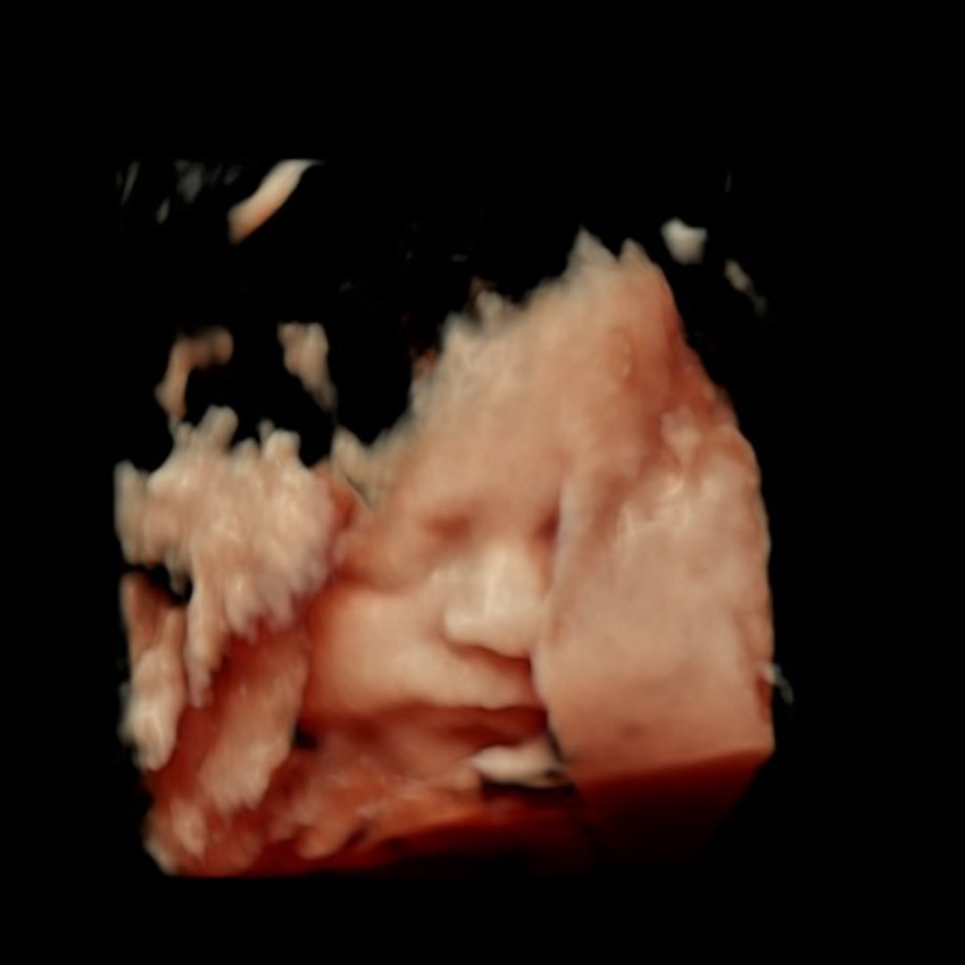 Photo shared by Caila for their Babylist baby registry.