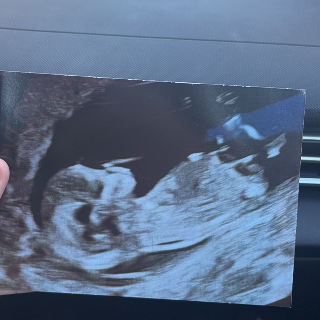 Photo shared by Kayla Alissa for their Babylist baby registry.