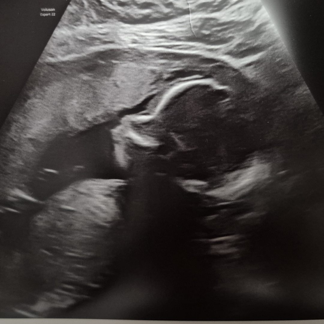 Photo shared by Adrianna for their Babylist baby registry.