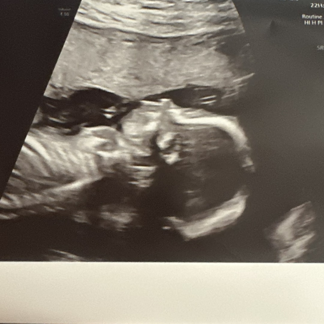 Photo shared by Ivett for their Babylist baby registry.