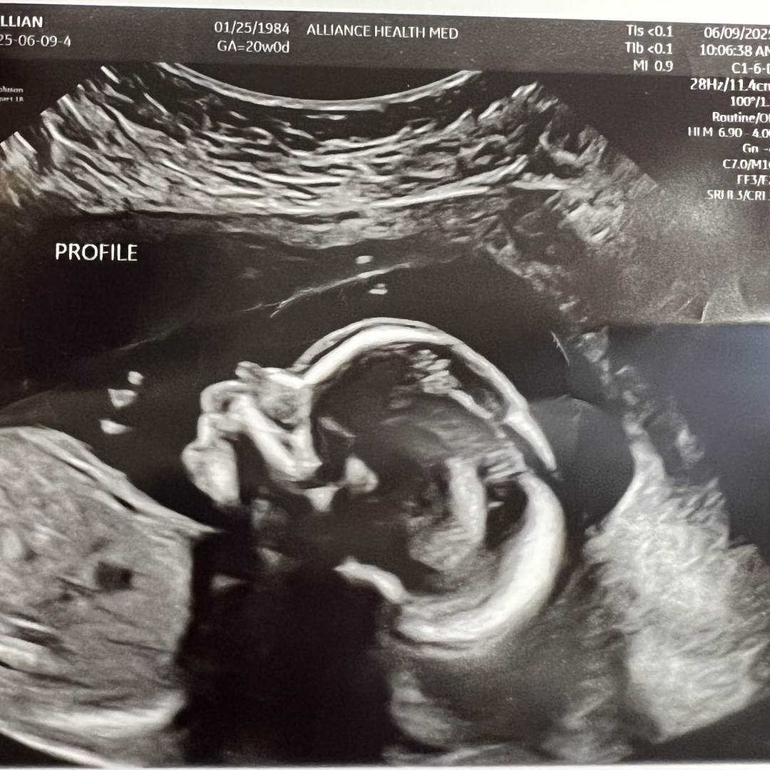 Photo shared by Jill for their Babylist baby registry.