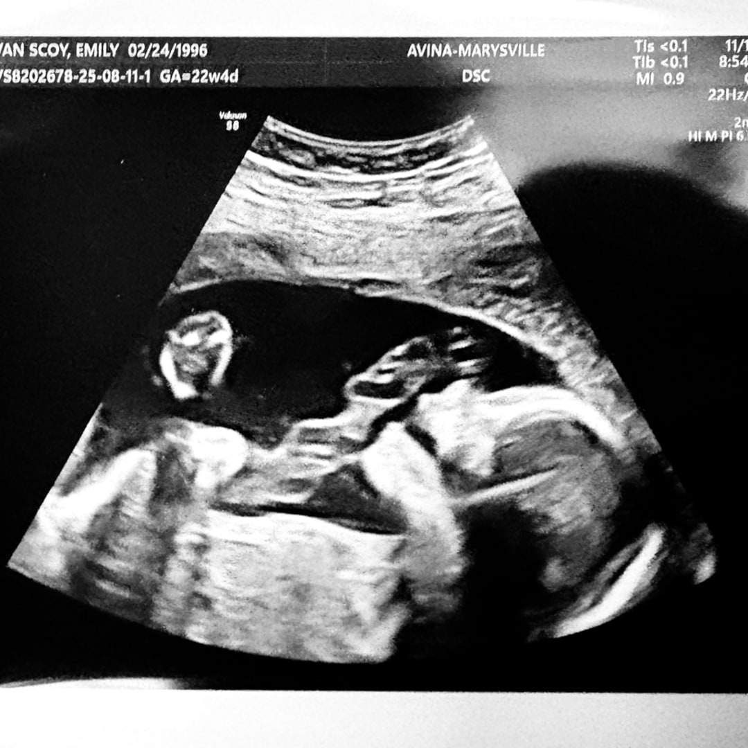 Photo shared by Emily for their Babylist baby registry.