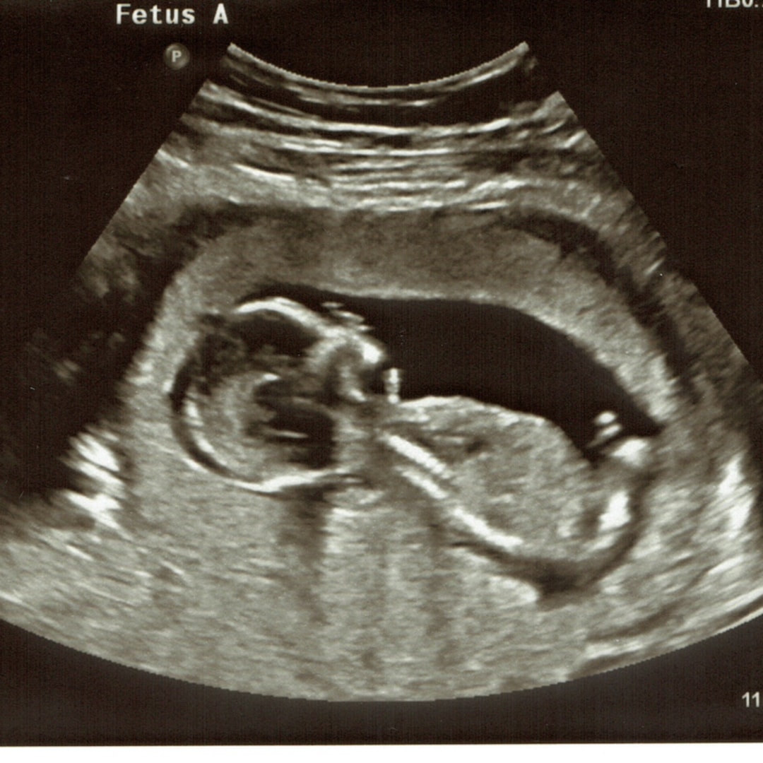 Photo shared by Patrick for their Babylist baby registry.