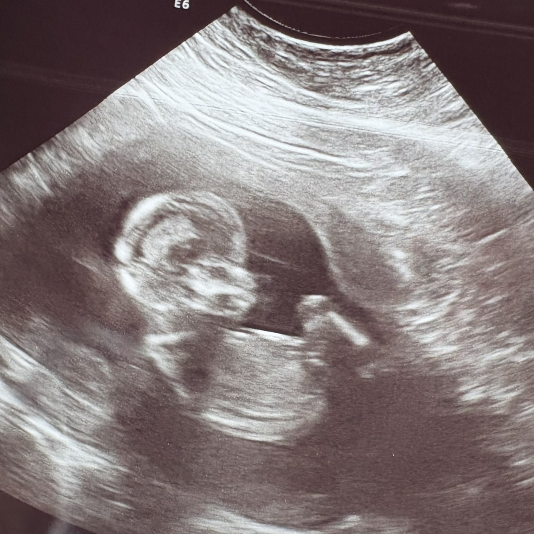 Photo shared by Julie for their Babylist baby registry.