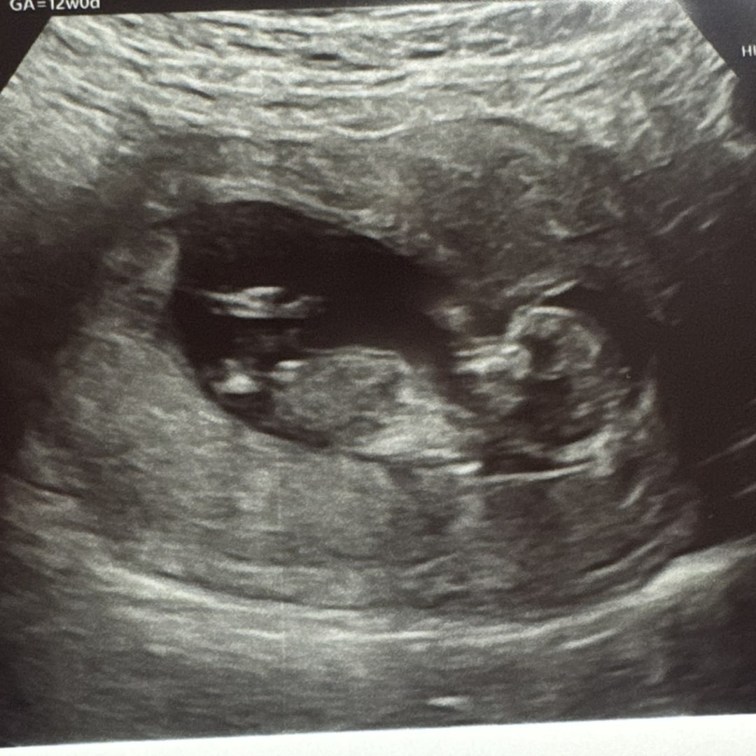 Photo shared by Olivia for their Babylist baby registry.