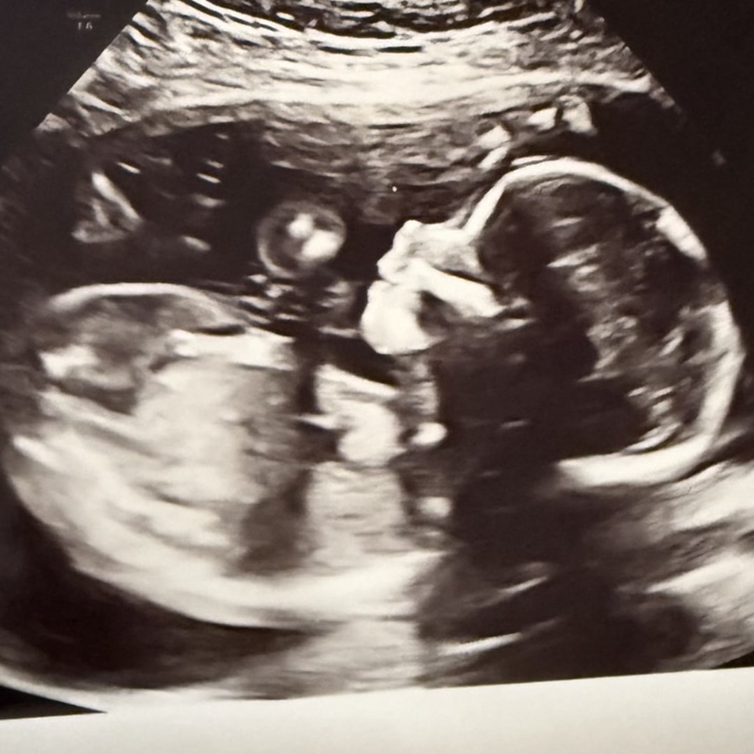 Photo shared by Chantal for their Babylist baby registry.