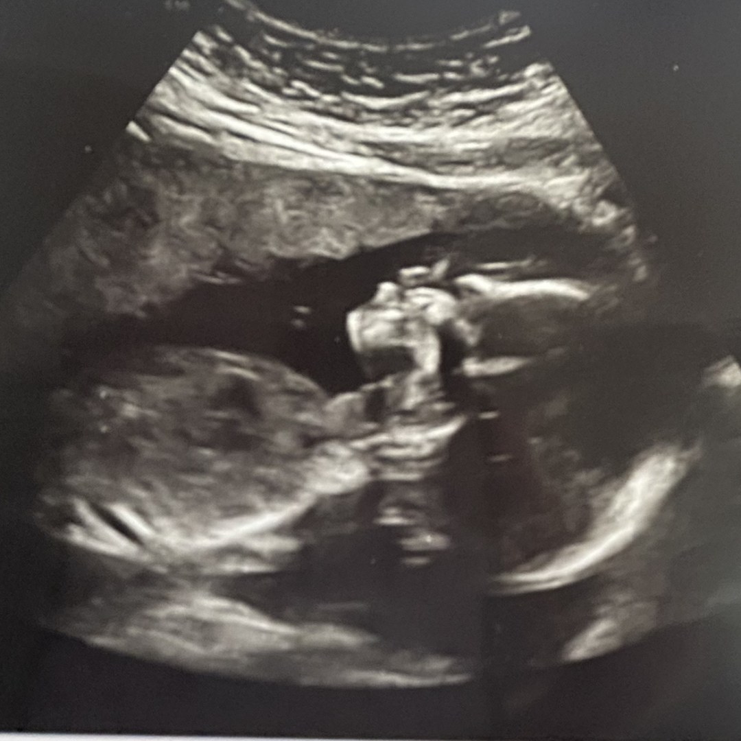 Photo shared by Destiny for their Babylist baby registry.
