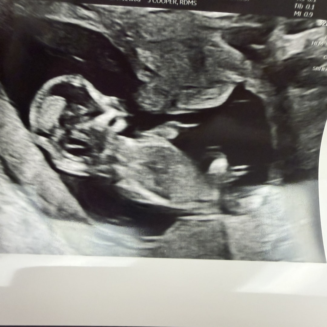 Photo shared by Rachel for their Babylist baby registry.