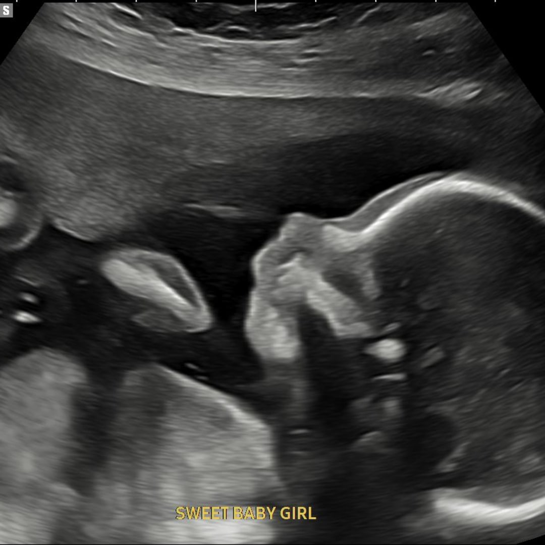 Photo shared by Sarah for their Babylist baby registry.