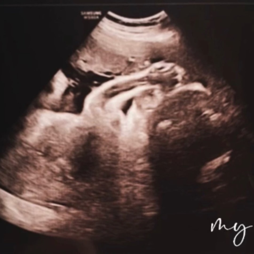 Photo shared by Ash for their Babylist baby registry.